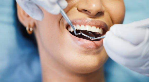 Best Emergency Dental Care for Broken or Chipped Teeth in Holt, AL